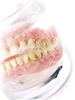 Dental Denture North London