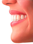 Invisalign Braces Southgate